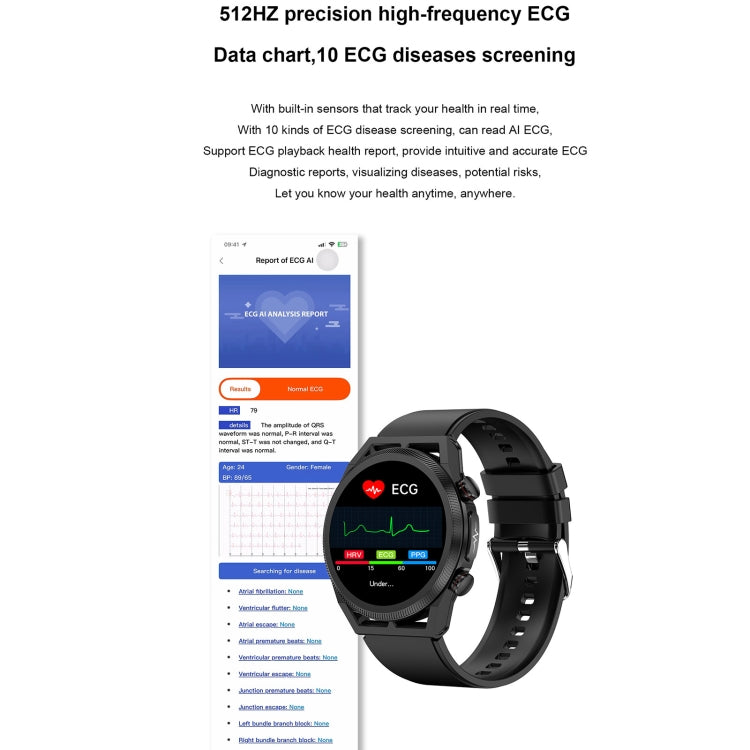 ET310 1.39 inch IPS Screen IP67 Waterproof Silicone Band Smart Watch, Support Body Temperature Monitoring / ECG, ET310