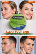 Nixoderm cream
