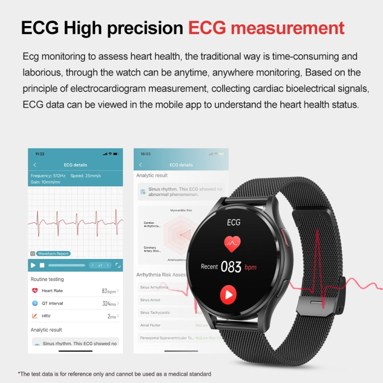 1.43 inch Milanese Steel Strap Bluetooth Call Smart Watch Support ECG / Non-invasive Blood Sugar, Milanese Steel Strap Black, Milanese Steel Strap Rose Gold