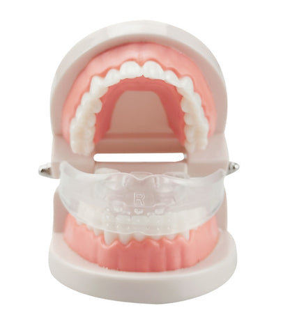 Orthodontic Appliance Silicone Simulation Braces Anti-molar Braces for Night, The first stage, The second stage, The third stage