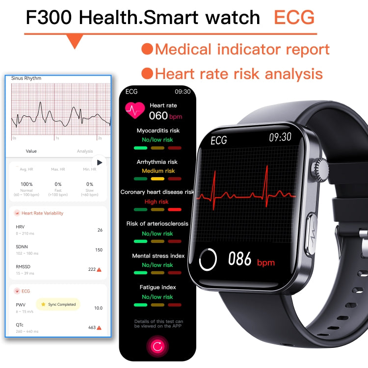 F300  2.1-Inch Screen Smart Watch Supports Bluetooth Calls/ECG/Blood Composition Analysis/50+ Sports Modes, Black Silicone, Black Pink Silicone, Black Gray Silicone, Black Milan, Black 3-Beads Steel, Black Leather, Black Brown Leather