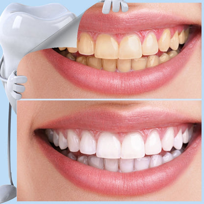 Professional Nano Teeth Whitening Oral Cleansing Set